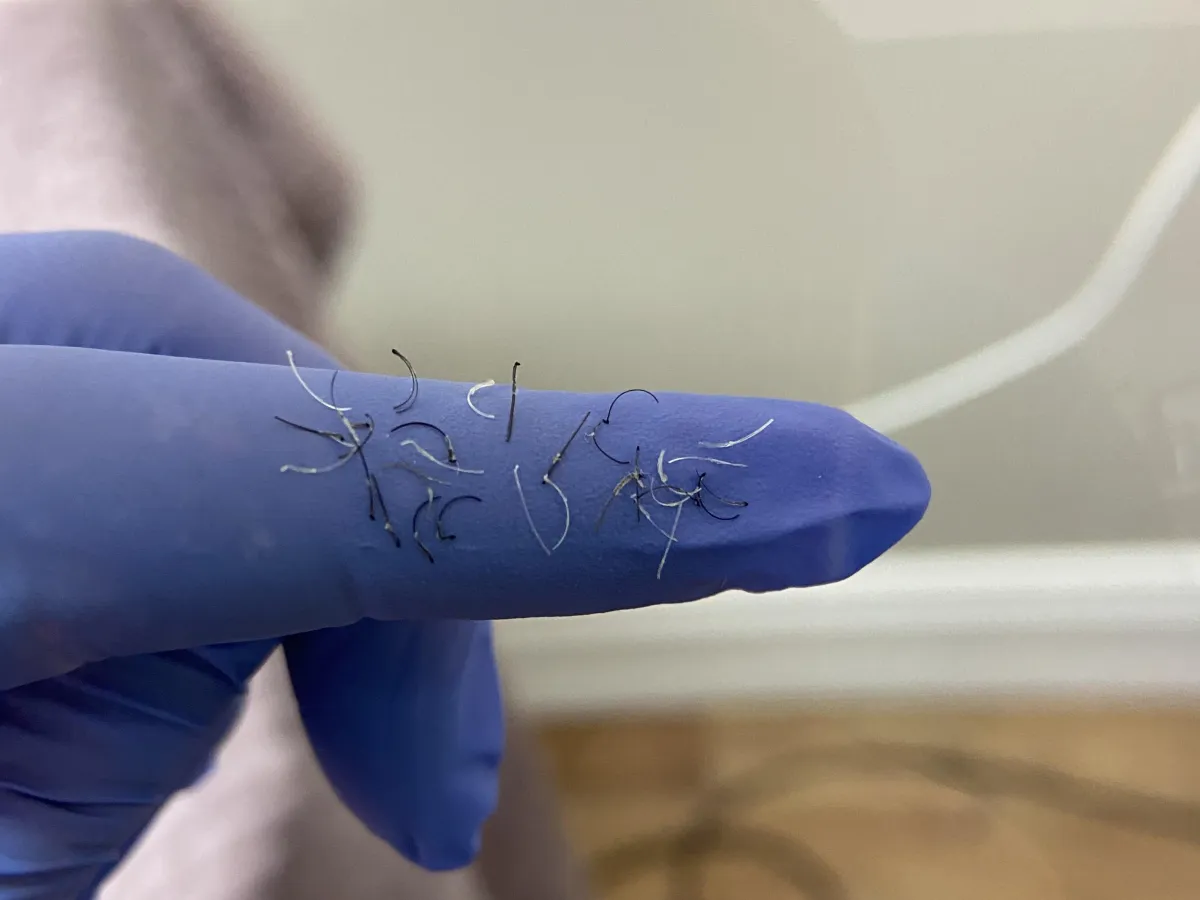Hairs removed by electrolysis